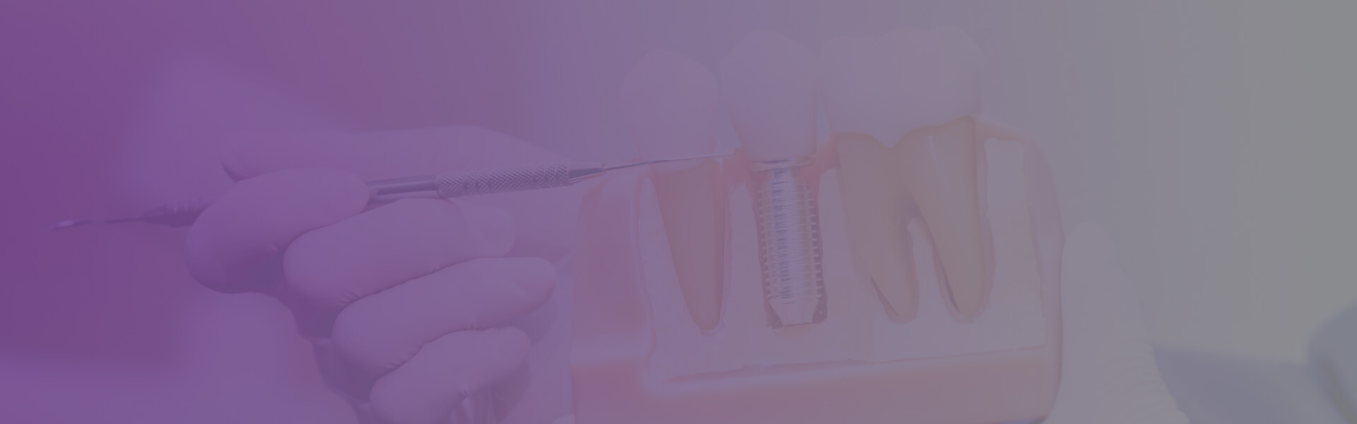 banner implante dentário